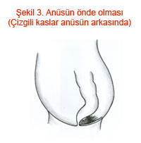 Anüsün önde olması (Çizgili kaslar anüsün arkasında)