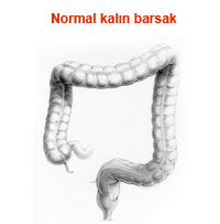 Normal Kalın Barsak